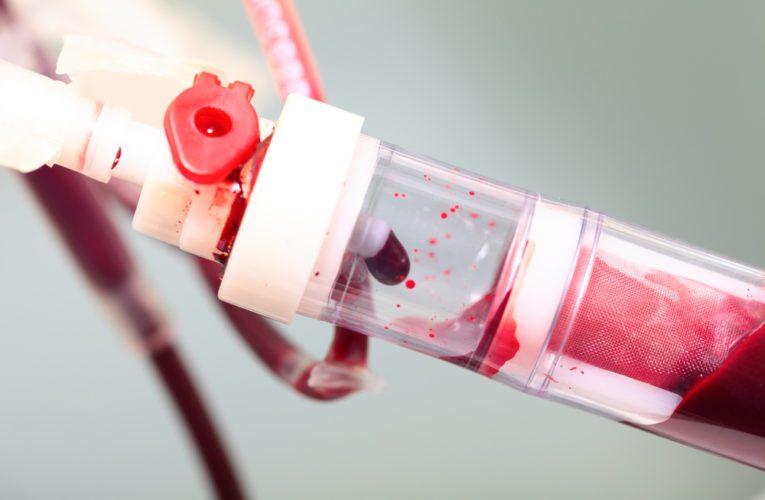 Boost Your Oxygen Levels and Immune System in Munich with IV Ozone Therapy